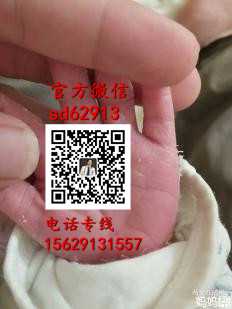 广州代怀孕最靠谱-为什么孕妇会长痔疮