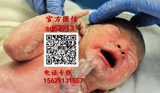 广州代孕在哪里_代孕费用一览_代孕医院要多少钱