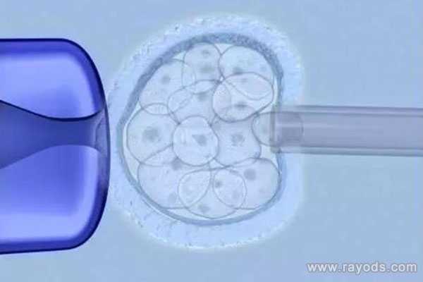广州代孕生孩子多少钱-2021年做供卵试管婴儿费用_泰国试管婴儿专家分析：养囊